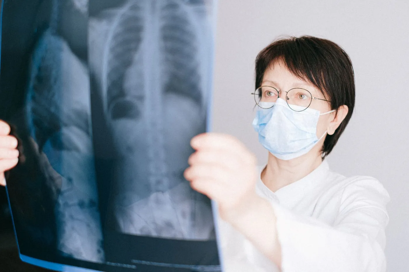 A doctor examining X-ray films