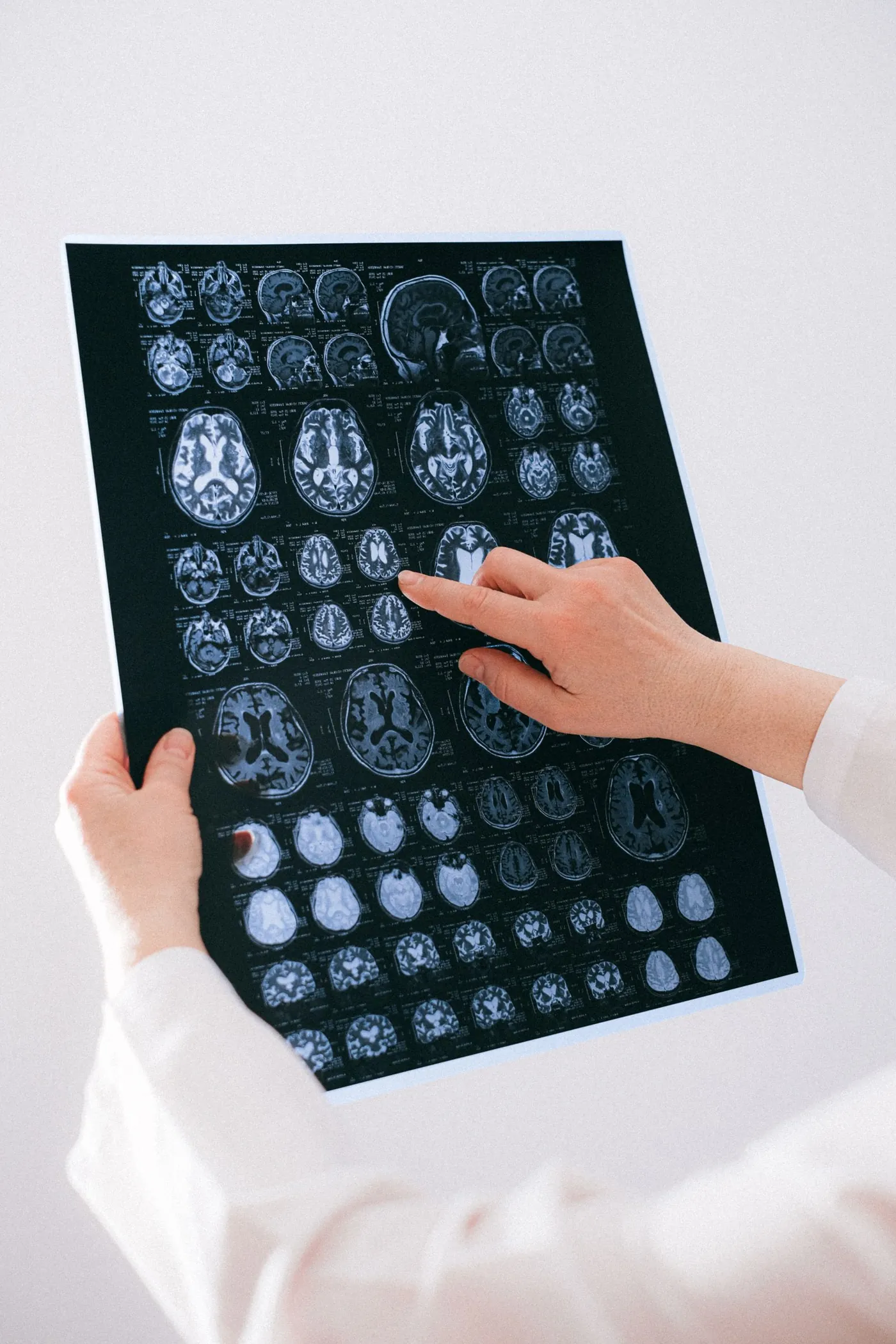 A doctor pointing at brain MRI films
